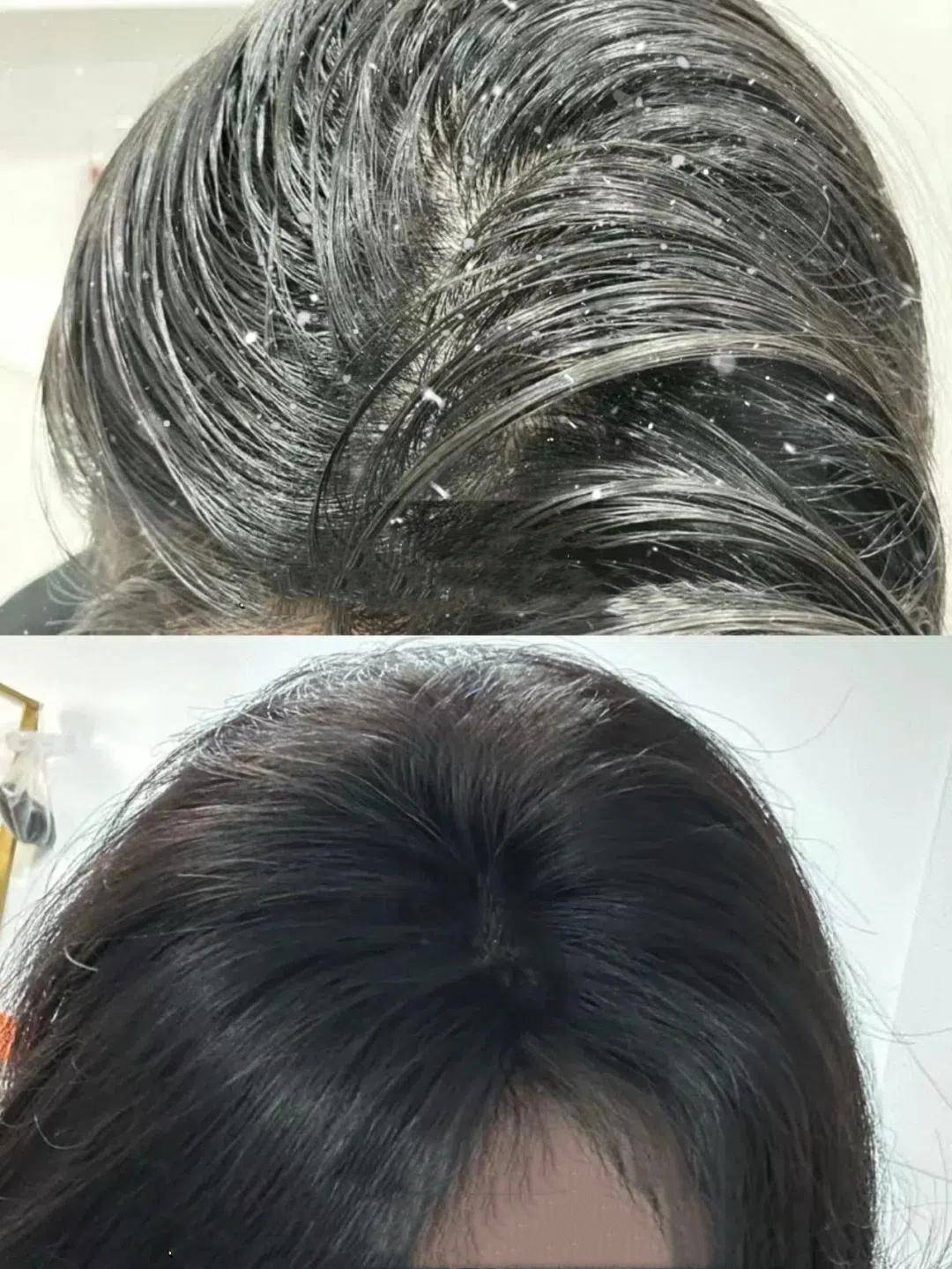 打造清爽控油蓬松发