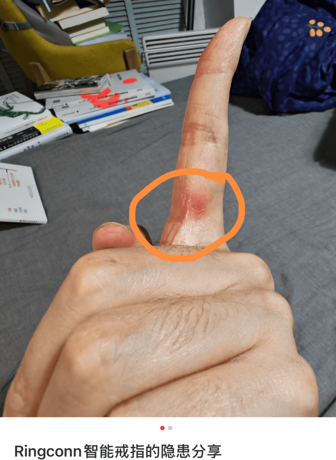 “3000一个、手指勒淤血”,但这“电子废物”还是成了金融男标配?