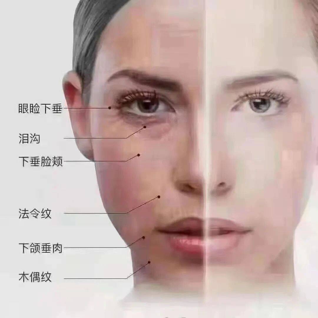 每日小知识：面部拨筋为什么会疼？_气血_筋节_脸色