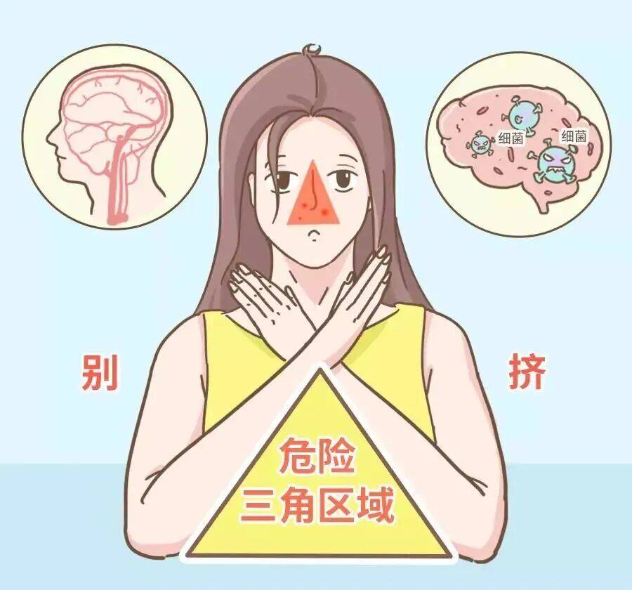 挤了颗痘痘，肺被“啃”出十几个洞！提醒：危险三角区千万别碰！