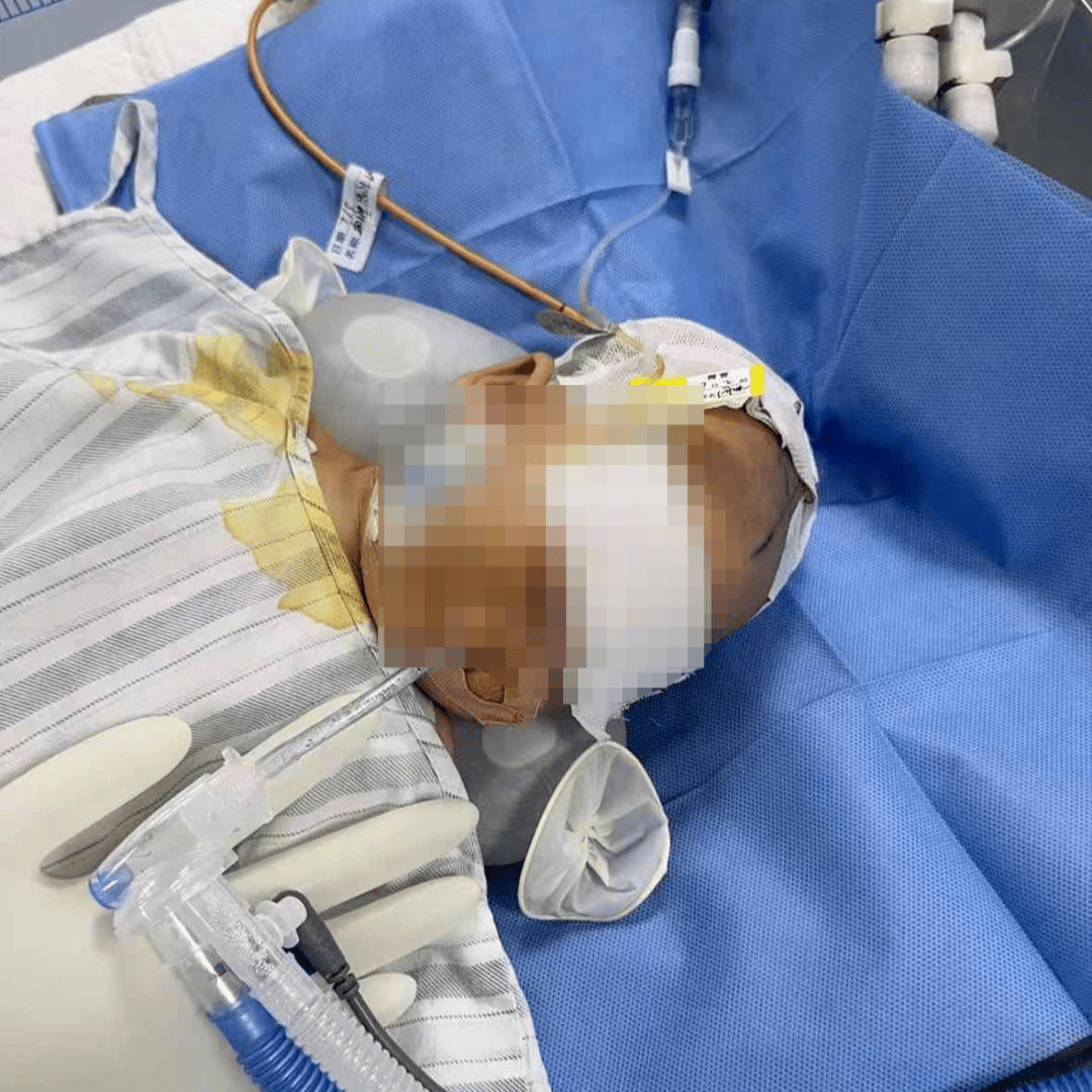 武汉2月龄女婴脑出血 家长曾质疑"