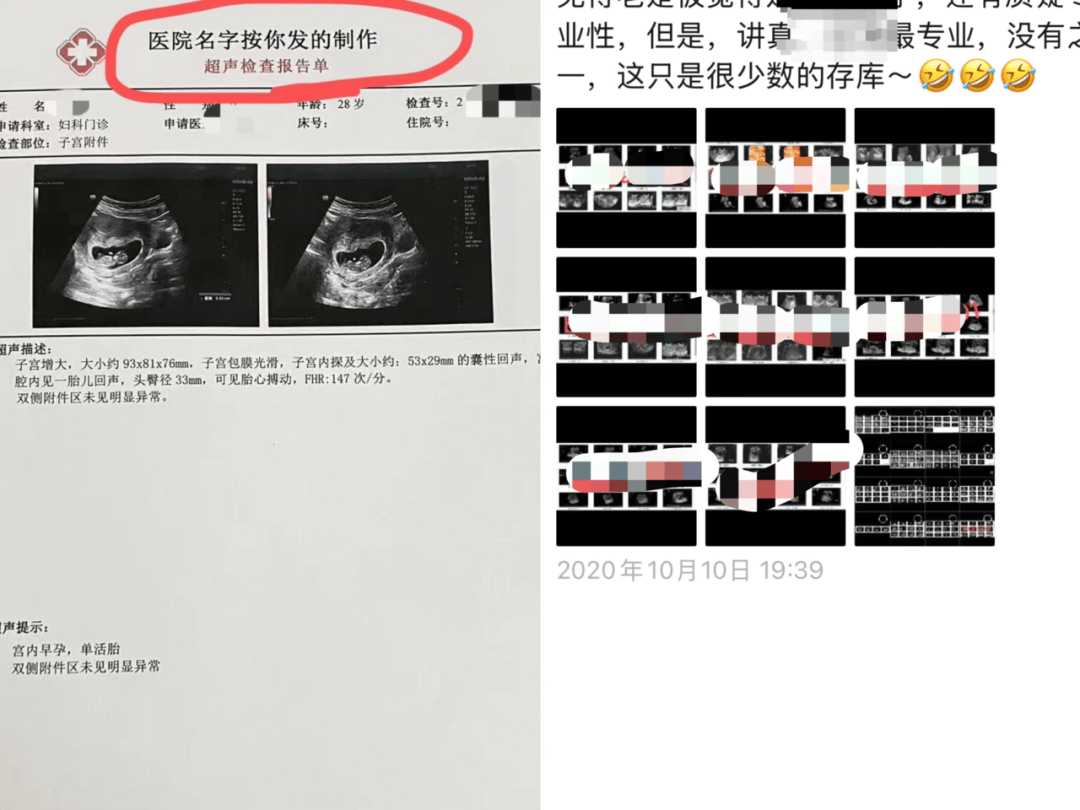 b超孕检单可以网购?有商家拍胸脯:专业医生看不出真假
