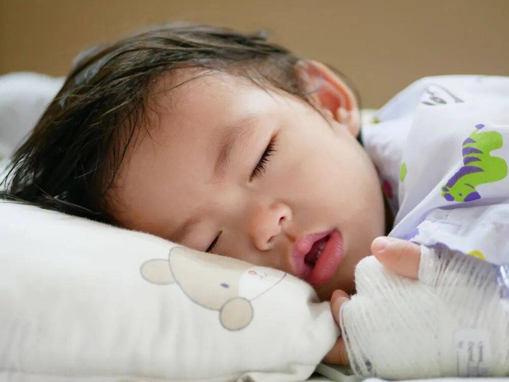 孩子嘴巴翘是腺样体面容吗？