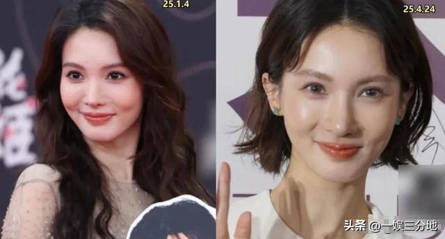 金晨晒满脸血迹的照片道歉,逃逸事件真相大白,却坐实另一个丑闻