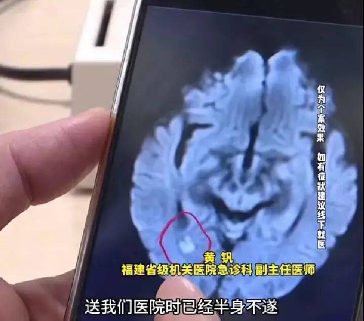 17岁高中生熬夜刷剧，突发脑梗半身不遂！和用“小太阳”有关？