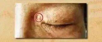 嘴唇发紫是心脏在“求救”？心脏不好的人，脸上会“报警”