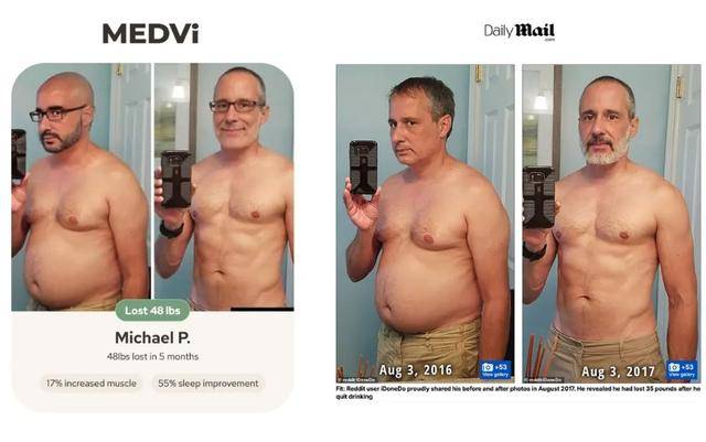 打脸来得太快！“10亿美元一人公司”MEDVi造假实锤