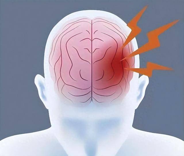 原创            早上起床后，若出现四种异常，很遗憾通知你：脑梗可能正在靠近