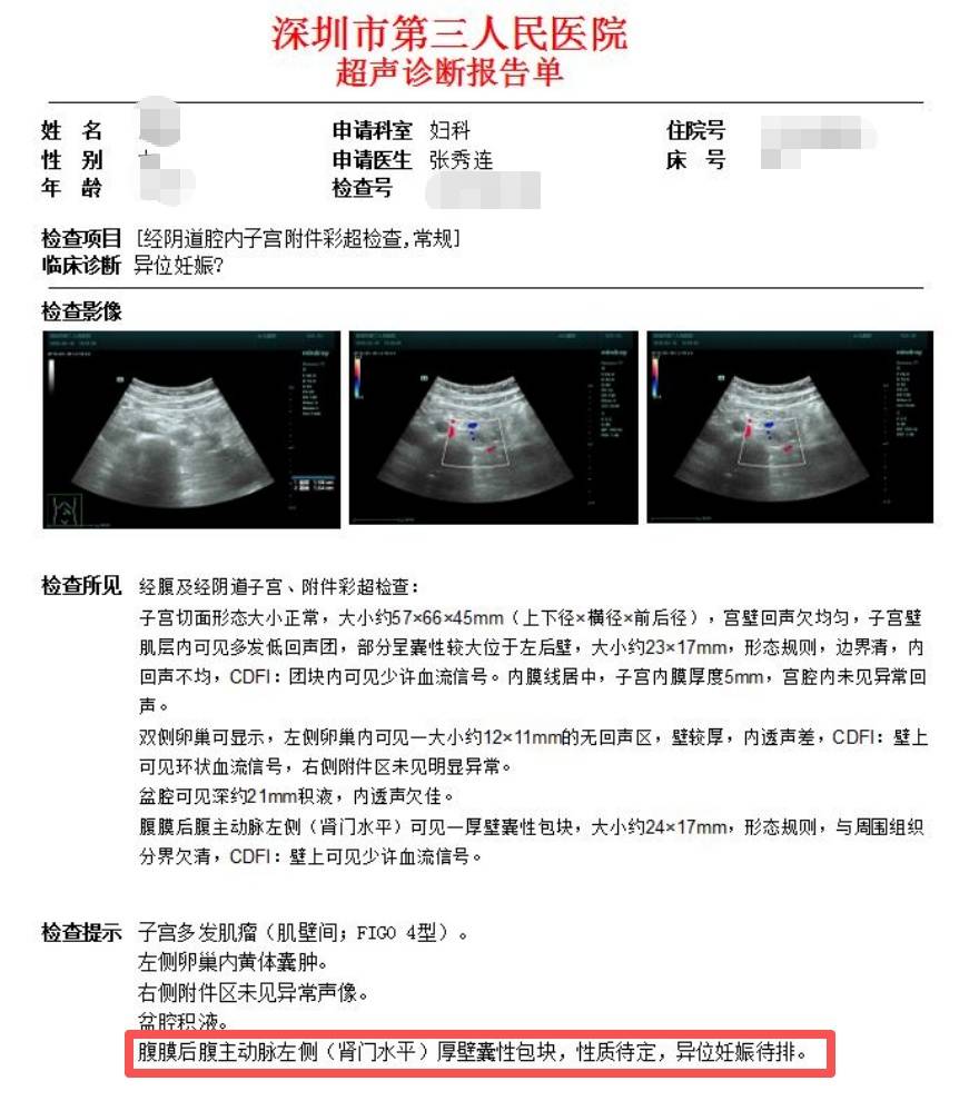 女子怀孕照B超却怎么也找不到“宝宝”！医生检查后惊了：非常罕见…