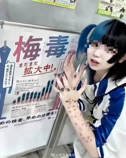 日本暴发梅毒疫情 -华闻时空